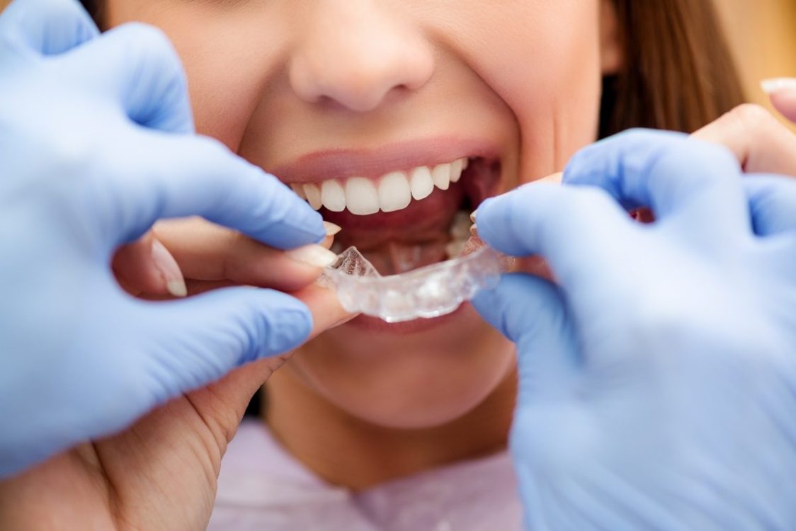 woman getting fitted with clear braces